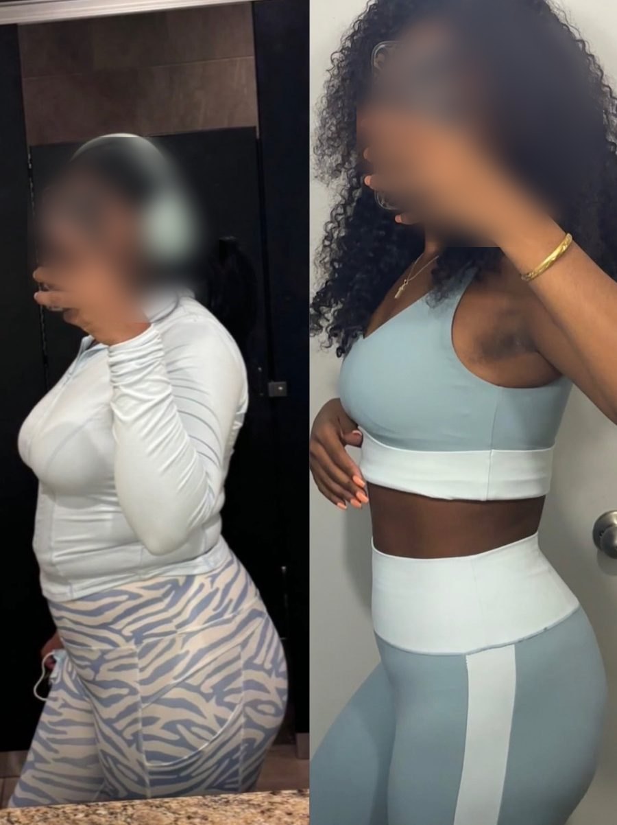 Client before and after — side view, visibly slimmer waist and tighter midsection