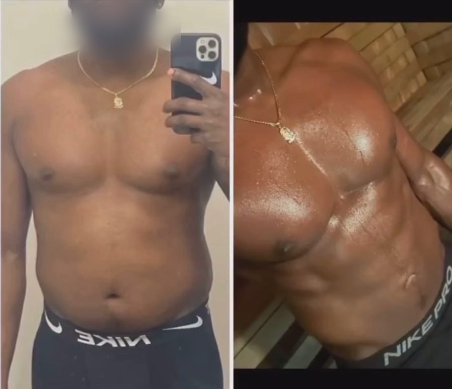Client before and after — torso, from a rounded midsection to defined chest and abs